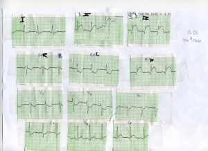 XXXVI CURSO ECG PARA ENFERMERÍA (NIVEL BÁSICO) - GRUPO DE TRABAJO DE ENFERMERIA