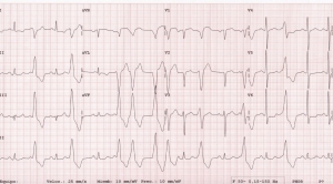 XX CURSO ECG PARA ENFERMERÍA (NIVEL AVANZADO) - GRUPO DE TRABAJO DE ENFERMERIA